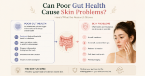 Can Poor Gut Health Cause Skin Problems? Here's What the Research Shows