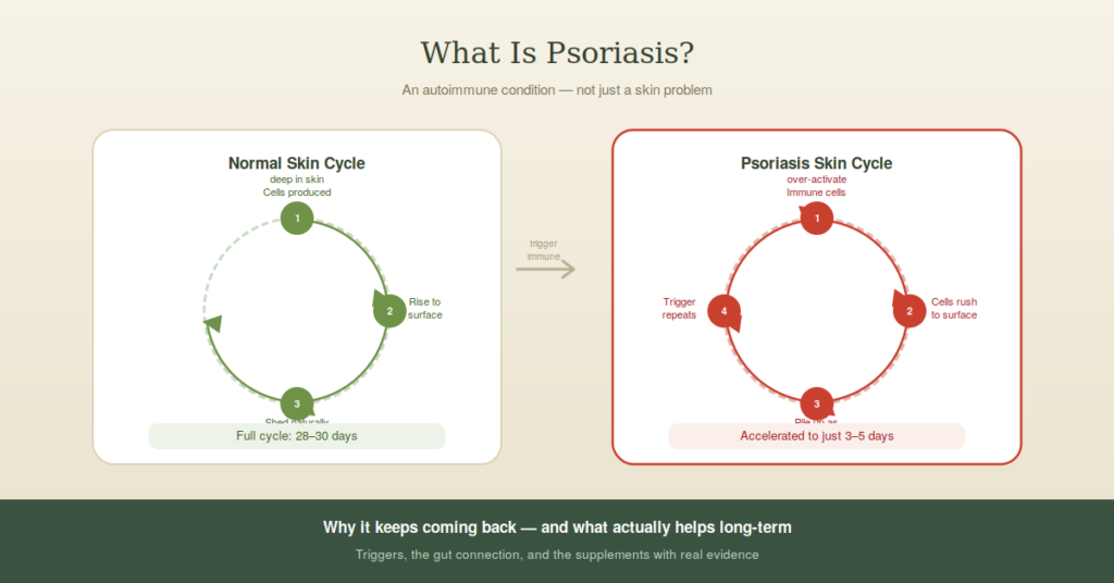 what is psoriasis and why does it keep coming back